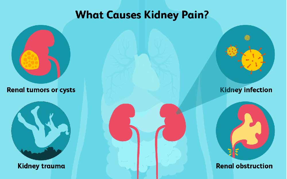 vzroki_bolecine_ledvic